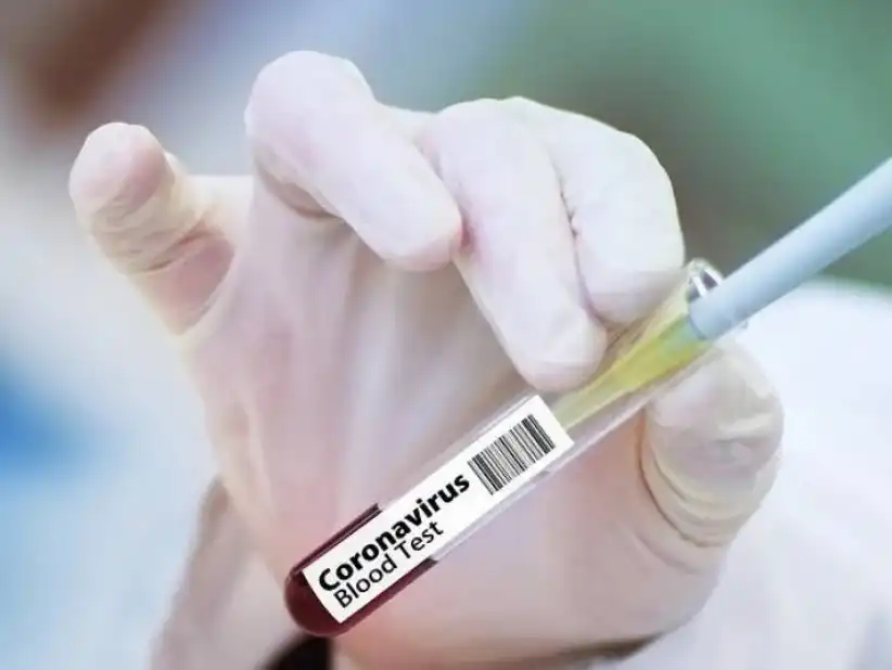 Najnowsze dane dotyczące koronawirusa (SARS-CoV-2) - 13 grudnia