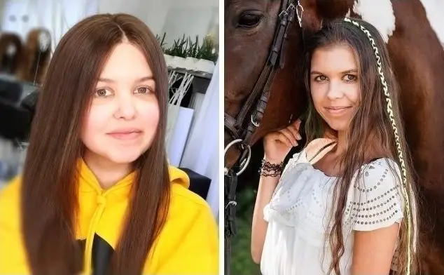 Nowy Sącz: Emilia walczy z glejakiem pnia mózgu. Trwa zbiórka pieniędzy na jej leczenie