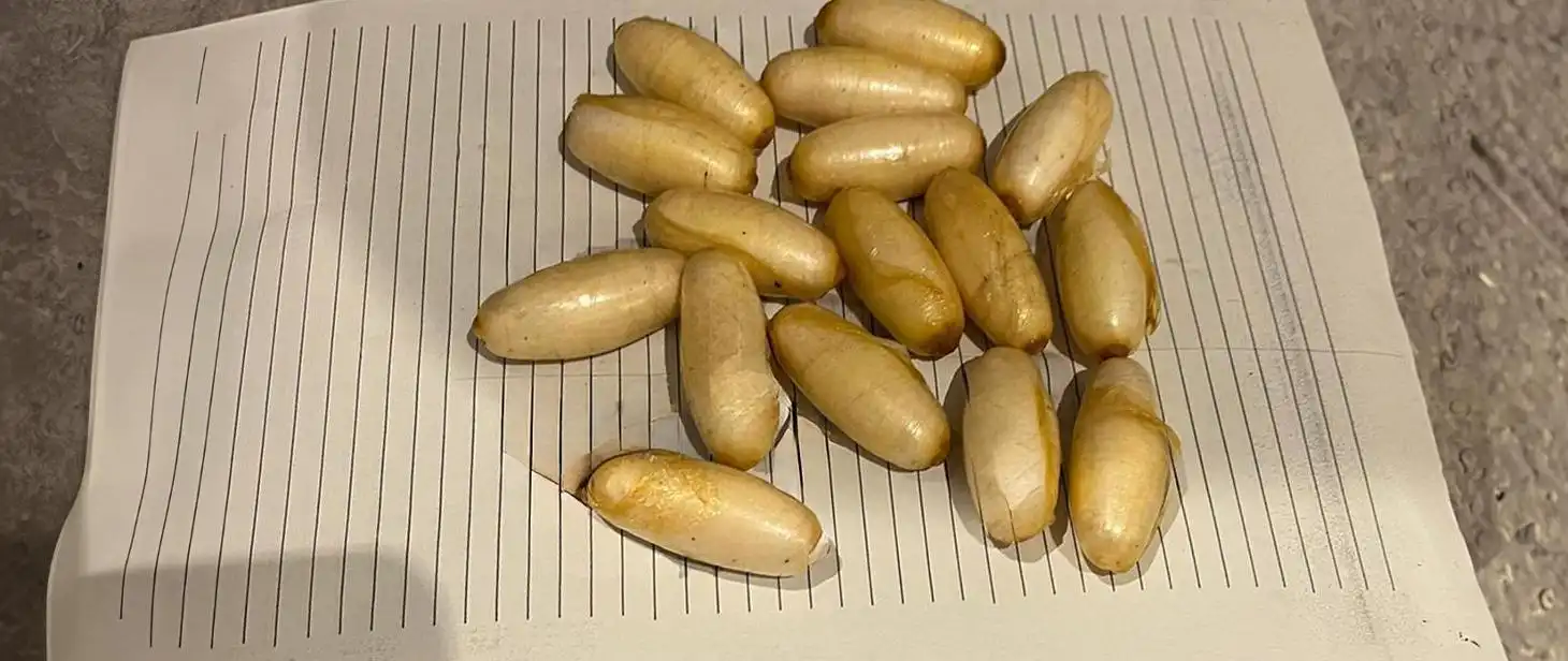 31 letni Nigeryjczyk z 1,25 kg kokainy w żołądku