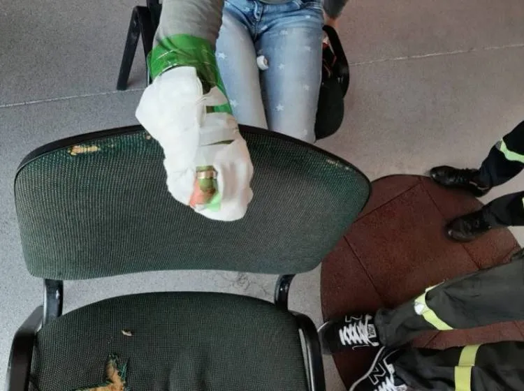 Obrączka kontra spuchnięty palec
