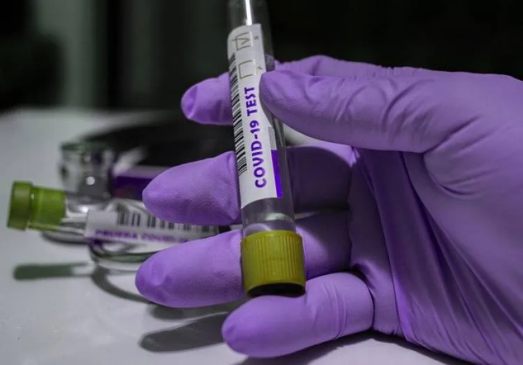 Najnowsze dane dotyczące koronawirusa (SARS-CoV-2) - 4 marca
