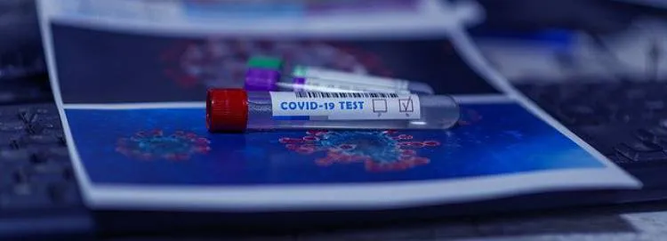Testy do szybkiej diagnostyki w kierunku SARS-CoV-2 trafią w tym tygodniu na SOR-y i izby przyjęć
