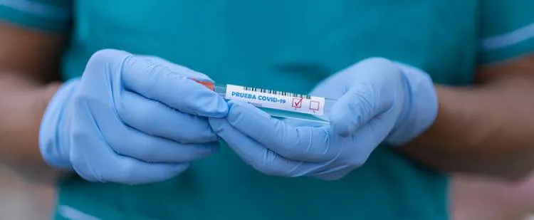 Najnowsze dane dotyczące koronawirusa (SARS-CoV-2) - 19 grudnia