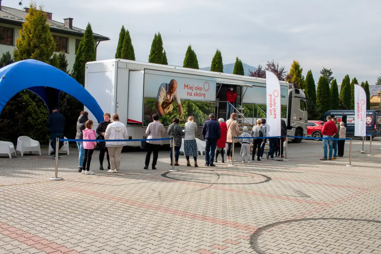 Akcja „Miej oko na skórę” w Mszanie Dolnej zakończona sukcesem